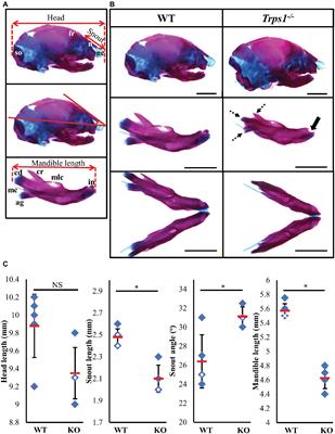 Trps1 Regulates Development of Craniofacial Skeleton and Is Required for the Initiation of Palatal Shelves Fusion